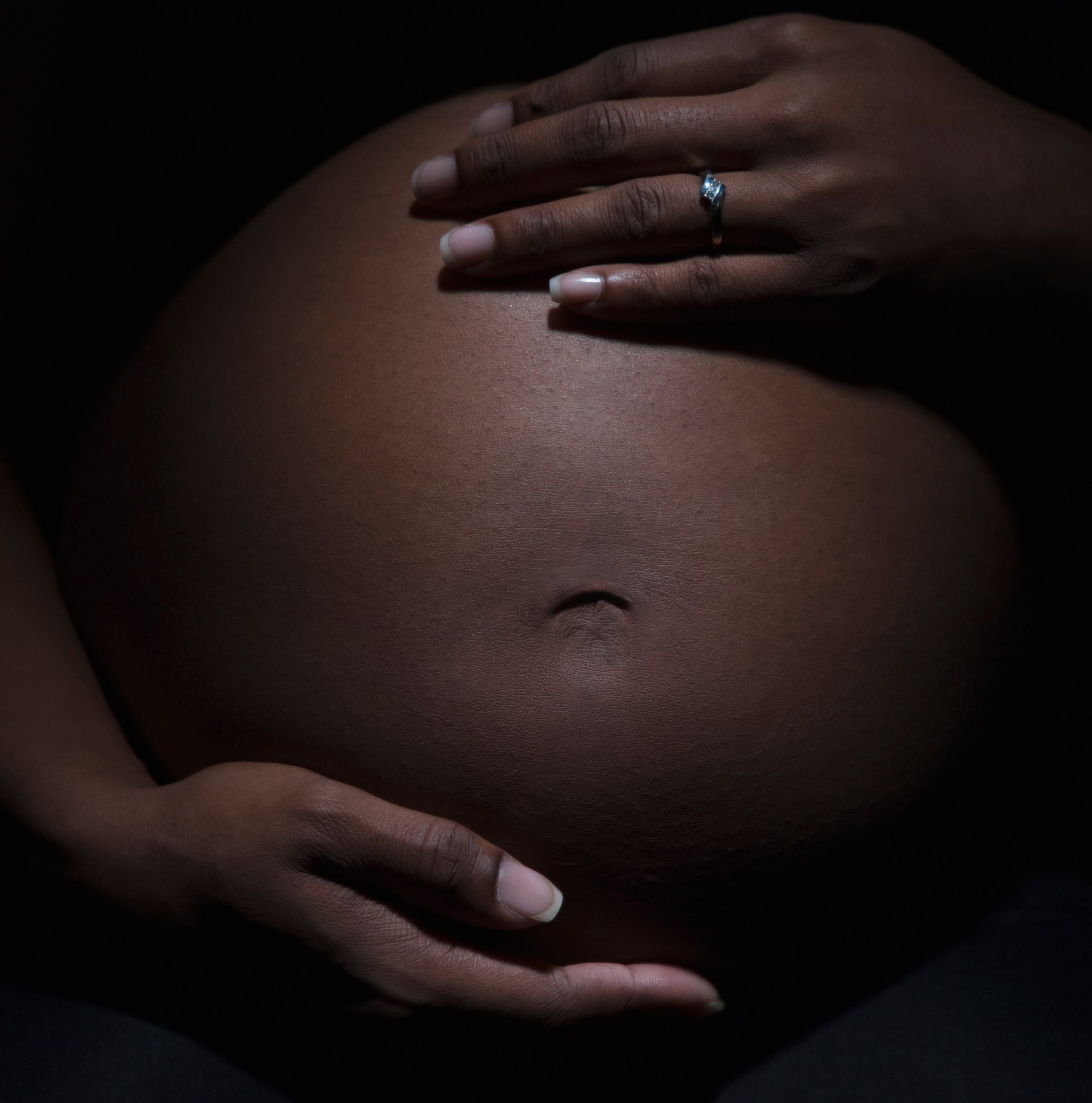 Pregnancy in America is starting to feel like a crime